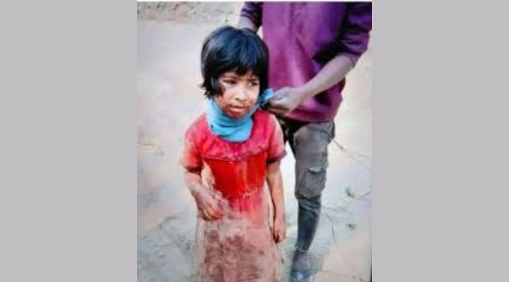 গলাকাটা অবস্থায় জঙ্গলে হাঁটছিল শিশুটি, কথা বলার শক্তিও ছিল না